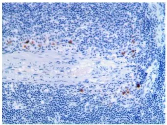 Anti-IL2 Receptor alpha antibody [MAB0710] used in IHC (Paraffin sections) (IHC-P). GTX53128