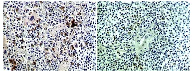 Anti-CD40L / CD154 antibody [MAB0712] used in IHC (Paraffin sections) (IHC-P). GTX53130
