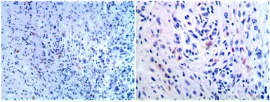 Anti-CD80 antibody [MAB0713] used in IHC (Paraffin sections) (IHC-P). GTX53131