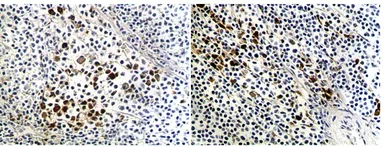 Anti-CD80 antibody [MAB0713] used in IHC (Paraffin sections) (IHC-P). GTX53131