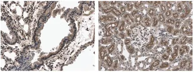 Anti-EphB6 antibody [9B17] used in IHC (Paraffin sections) (IHC-P). GTX53146