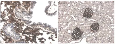 Anti-Podoplanin antibody [10C3] used in IHC (Paraffin sections) (IHC-P). GTX53151