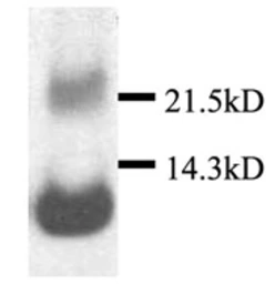 Anti-BCA1 antibody used in Western Blot (WB). GTX53178