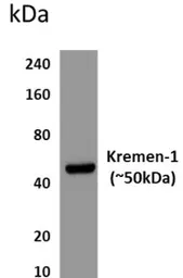 Anti-KREMEN1 antibody [6K45] used in Western Blot (WB). GTX53210