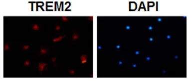 Anti-TREM-2b antibody [5J46] used in Immunocytochemistry/ Immunofluorescence (ICC/IF). GTX53229