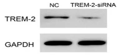 Anti-TREM-2b antibody [5J46] used in Western Blot (WB). GTX53229