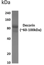 Anti-Decorin antibody [11F32] used in Western Blot (WB). GTX53321