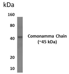 Anti-IL2 Receptor gamma antibody [6A21] used in Western Blot (WB). GTX53453