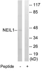 Anti-NEIL1 antibody used in Western Blot (WB). GTX53473
