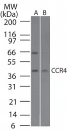 Anti-CCR4 antibody used in Western Blot (WB). GTX53474