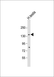Anti-Cav alpha 2/delta 2 antibody used in Western Blot (WB). GTX53487