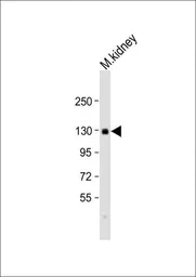 Anti-Cav alpha 2/delta 2 antibody used in Western Blot (WB). GTX53487