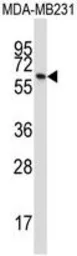Anti-BTN3A1 antibody used in Western Blot (WB). GTX53488