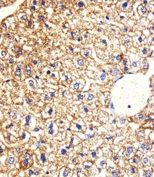 Anti-Casein Kinase I gamma 3 antibody used in IHC (Paraffin sections) (IHC-P). GTX53489