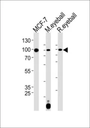 Anti-COL9A1 antibody used in Western Blot (WB). GTX53514
