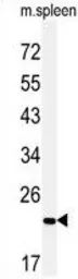 Anti-COPZ2 antibody used in Western Blot (WB). GTX53526