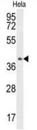 Anti-CMPK2 antibody used in Western Blot (WB). GTX53527