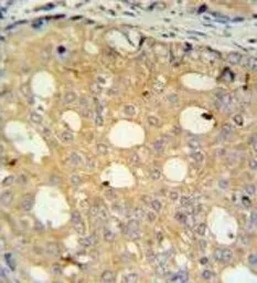 Anti-CMPK2 antibody used in IHC (Paraffin sections) (IHC-P). GTX53527