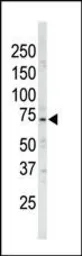 Anti-ARK5 antibody used in Western Blot (WB). GTX53533