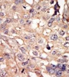 Anti-ARK5 antibody used in IHC (Paraffin sections) (IHC-P). GTX53533
