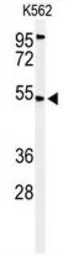 Anti-Mitochondrial calcium uptake 1 antibody used in Western Blot (WB). GTX53535