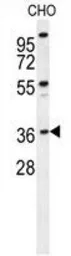 Anti-Exonuclease 5 antibody used in Western Blot (WB). GTX53538