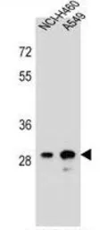 Anti-DHRS4L1 antibody used in Western Blot (WB). GTX53550
