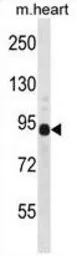 Anti-Dystrobrevin alpha antibody used in Western Blot (WB). GTX53551