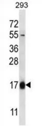 Anti-Hemoglobin theta 1 antibody used in Western Blot (WB). GTX53555