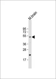 Anti-HtrA1 antibody used in Western Blot (WB). GTX53558