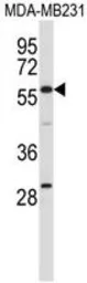 Anti-EHD1 antibody used in Western Blot (WB). GTX53560