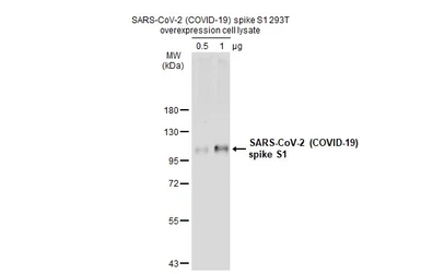 SARS-CoV-2 (COVID-19) Spike S1 overexpression 293T whole cell lysate. GTX535663