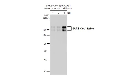 SARS-CoV Spike overexpression 293T whole cell lysate. GTX535668