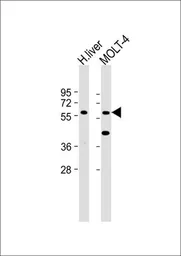 Anti-GXYLT2 antibody used in Western Blot (WB). GTX53588