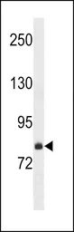Anti-FCHSD2 antibody used in Western Blot (WB). GTX53590