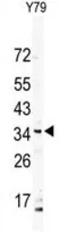 Anti-DSCR3 antibody used in Western Blot (WB). GTX53603