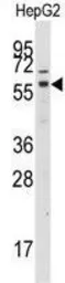 Anti-GRK7 antibody used in Western Blot (WB). GTX53604