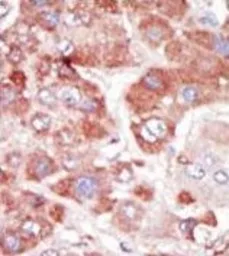 Anti-GRK7 antibody used in IHC (Paraffin sections) (IHC-P). GTX53604