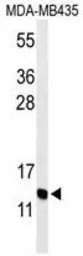 Anti-GNRH2 antibody used in Western Blot (WB). GTX53607