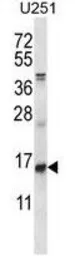 Anti-ID1 antibody used in Western Blot (WB). GTX53624