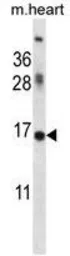 Anti-ID1 antibody used in Western Blot (WB). GTX53624