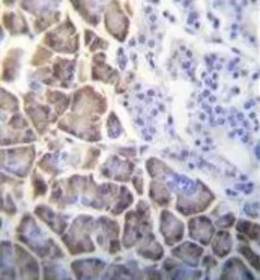 Anti-ID1 antibody used in IHC (Paraffin sections) (IHC-P). GTX53624