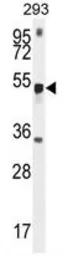 Anti-METTL4 antibody used in Western Blot (WB). GTX53629