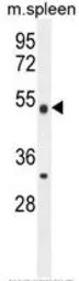 Anti-METTL4 antibody used in Western Blot (WB). GTX53629