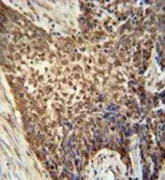 Anti-METTL4 antibody used in IHC (Paraffin sections) (IHC-P). GTX53629
