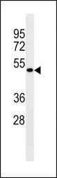 Anti-MCIDAS antibody used in Western Blot (WB). GTX53649