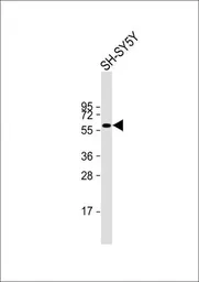 Anti-IRX3 antibody used in Western Blot (WB). GTX53650
