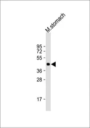 Anti-MBOAT4 antibody used in Western Blot (WB). GTX53651