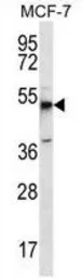 Anti-MBOAT4 antibody used in Western Blot (WB). GTX53651