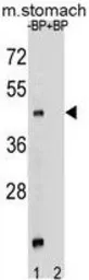 Anti-MBOAT4 antibody used in Western Blot (WB). GTX53651